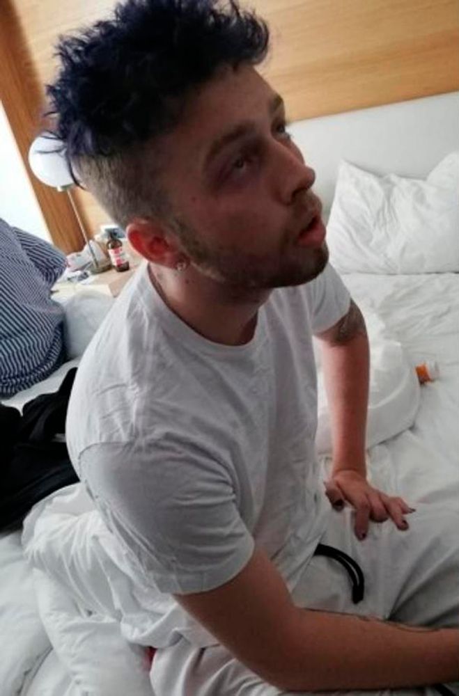In this photo release by Italian Carabinieri, Finnegan Lee Elder sits in his hotel room in Rome. Two American teenagers were jailed in Rome on Saturday as authorities carry out a murder investigation in the killing of Italian police officer Mario Cerciello Rega, 35. A detention order issued by prosecutors was shown on Italian state broadcaster RAI, naming the suspects as Gabriel Christian Natale Hjorth and Finnegan Lee Elder. (Italian Carabinieri via AP) In this photo release by Italian Carabinieri, Finnegan Lee Elder sits in his hotel room in Rome. Two American teenagers were jailed in Rome on Saturday as authorities carry out a murder investigation in the killing of Italian police officer Mario Cerciello Rega, 35. A detention order issued by prosecutors was shown on Italian state broadcaster RAI, naming the suspects as Gabriel Christian Natale Hjorth and Finnegan Lee Elder. (Italian Carabinieri via AP)