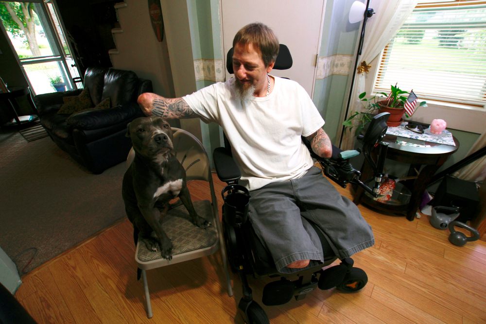 In this Aug. 16, 2019 photo, Greg Manteufel pets his dog Ellie at his home in West Bend, Wis. Manteufel lost parts of his arms and legs, as well as the skin of his nose and part of his upper lip from capnocytophaga, a bacteria commonly found in the saliva or cats and dogs that almost never leads to people getting sick, unless the person has a compromised immune system. He was perfectly healthy when he got sick in June of 2018. Over the last seven years, a team of researchers at Brigham and Women's Hospital in Boston, connected to Harvard Medical School, have tested other healthy people who were affected and developed a theory on why they were affected- a gene change in all the victims. (AP Photo/Carrie Antlfinger) In this Aug. 16, 2019 photo, Greg Manteufel pets his dog Ellie at his home in West Bend, Wis. Manteufel lost parts of his arms and legs, as well as the skin of his nose and part of his upper lip from capnocytophaga, a bacteria commonly found in the saliva or cats and dogs that almost never leads to people getting sick, unless the person has a compromised immune system. He was perfectly healthy when he got sick in June of 2018. Over the last seven years, a team of researchers at Brigham and Women's Hospital in Boston, connected to Harvard Medical School, have tested other healthy people who were affected and developed a theory on why they were affected- a gene change in all the victims. (AP Photo/Carrie Antlfinger)