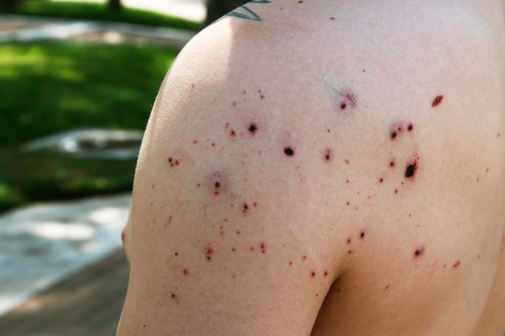 Daniel Munoz shows his injuries during an interview Sunday, Sept. 1, 2019, in Odessa, Texas, that were sustained in Saturday's shooting. (AP Photo/Sue Ogrocki) Daniel Munoz shows his injuries during an interview Sunday, Sept. 1, 2019, in Odessa, Texas, that were sustained in Saturday's shooting. (AP Photo/Sue Ogrocki)