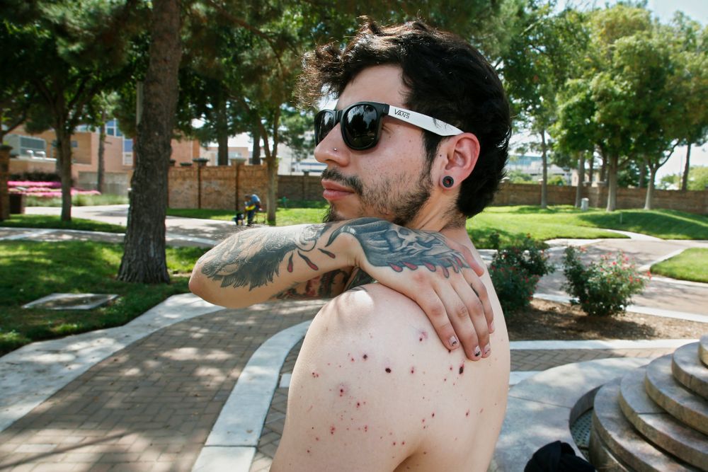 Daniel Munoz reaches for his injured back during an interview, Sunday, Sept. 1, 2019, in Odessa, Texas. Munoz was injured in Saturday's shooting. The tattoo on his right hand is a biblical reference, that the wages of sin are death and God's gift is everlasting life. (AP Photo/Sue Ogrocki) Daniel Munoz reaches for his injured back during an interview, Sunday, Sept. 1, 2019, in Odessa, Texas. Munoz was injured in Saturday's shooting. The tattoo on his right hand is a biblical reference, that the wages of sin are death and God's gift is everlasting life. (AP Photo/Sue Ogrocki)