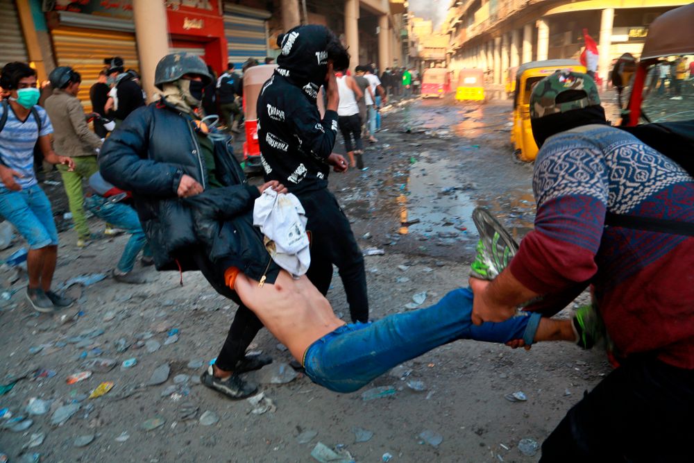 An injured protester is rushed to a hospital during clashes between security forces and anti-government protesters in Baghdad, Iraq, Sunday, Nov. 24, 2019. At least 342 people have died since demonstrations began Oct. 1, when thousands of Iraqis, mostly youth, took to the streets to decry corruption and poor services. The leaderless uprising seeks to overthrow the political establishment. (AP Photo/Khalid Mohammed) An injured protester is rushed to a hospital during clashes between security forces and anti-government protesters in Baghdad, Iraq, Sunday, Nov. 24, 2019. At least 342 people have died since demonstrations began Oct. 1, when thousands of Iraqis, mostly youth, took to the streets to decry corruption and poor services. The leaderless uprising seeks to overthrow the political establishment. (AP Photo/Khalid Mohammed)